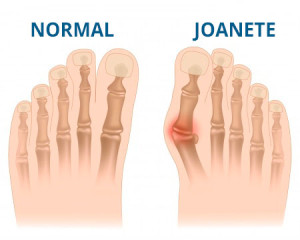 IlustraÃ§Ã£o da Joanete