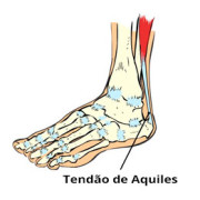 TendÃ£o de Aquiles